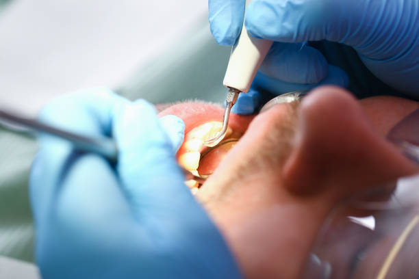 Best Same-Day Emergency Dentist in Pembroke, VA